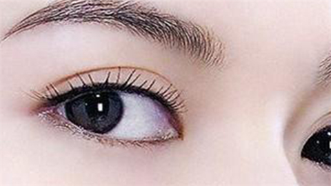 眼部整形手術(shù)醫(yī)院哪里好？2022全國(guó)眼部整形醫(yī)院排名前十