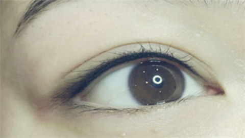 開眼角哪個醫(yī)院做的好？2022開眼角醫(yī)院排名前十