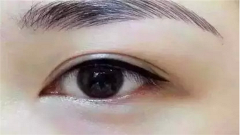 昆山雙眼皮整形醫(yī)院哪幾家好？實(shí)力口碑醫(yī)院推薦！