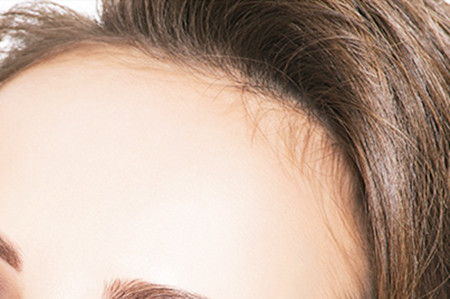 武漢植發(fā)整形醫(yī)院排名更新！實力口碑醫(yī)院推薦！