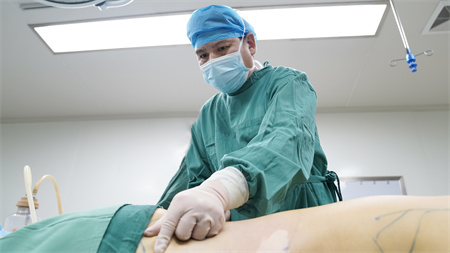 常熟瑞麗美貝爾美容醫(yī)院_吸脂過程