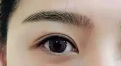 廈門眼部整形醫(yī)院排名榜盤點(diǎn)！10家正規(guī)機(jī)構(gòu)供你挑選！