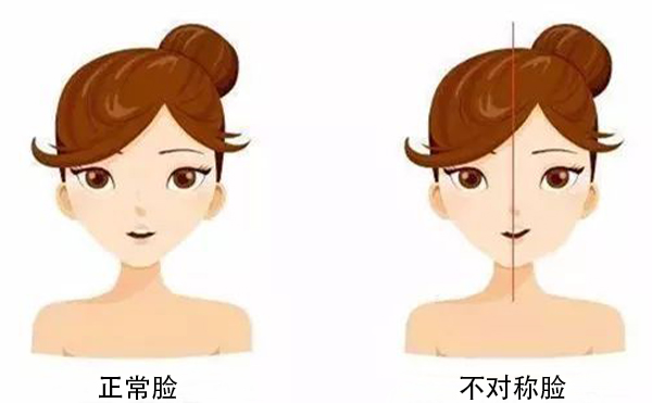 面部不對(duì)稱