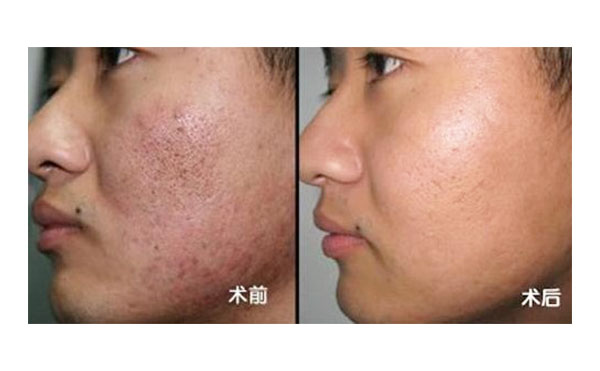 黑臉娃娃有風(fēng)險(xiǎn)嗎？