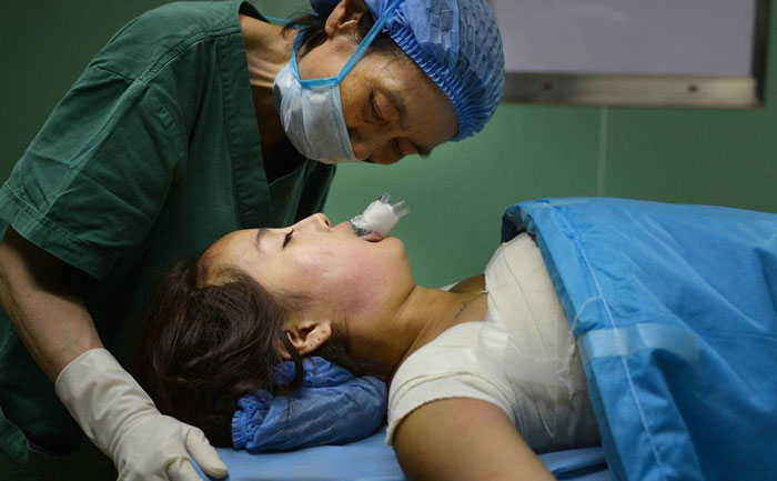 假體隆胸效果自然嗎？能維持多久？