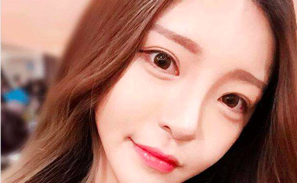 韓式開眼角的費用是多少？