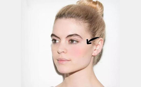 玻尿酸豐蘋果肌怎么樣？