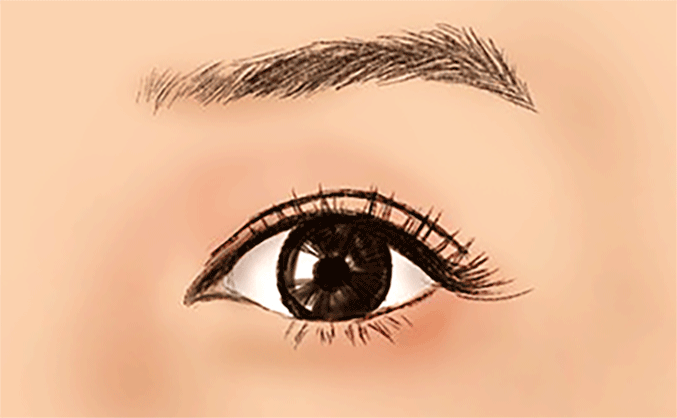 無(wú)痕開(kāi)眼角的價(jià)格是多少？