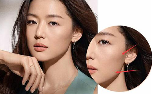 胖人先胖臉，請問該怎么瘦臉?