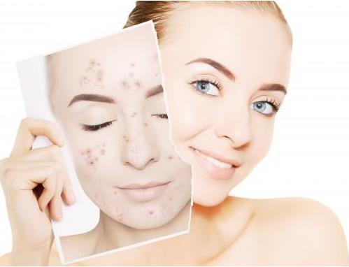 面部提拉緊致繃帶有效果嗎？