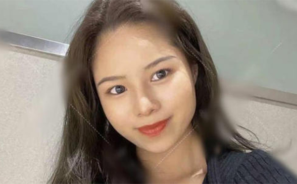 鼻再造手術(shù)成功率高嗎？