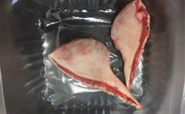 濟南海峽整形：下頜角整形術后就該這么做