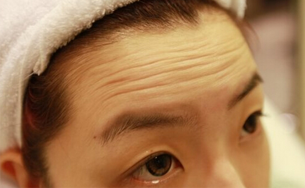 抬頭紋是怎么形成的？