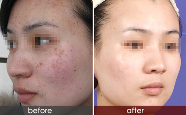 白瓷娃娃的效果怎么樣？