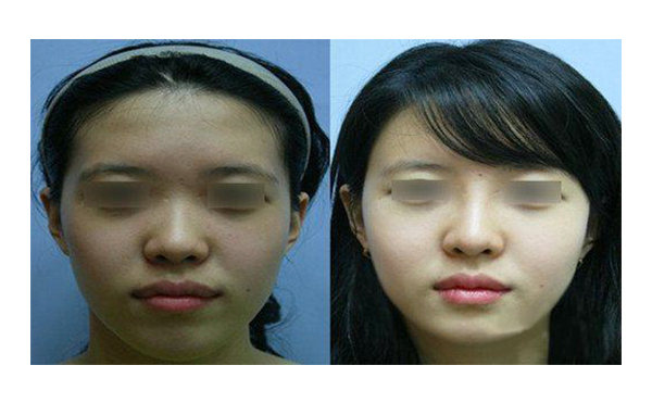 做白瓷娃娃多少錢？