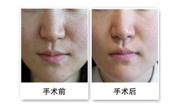 黑臉娃娃能維持多久？