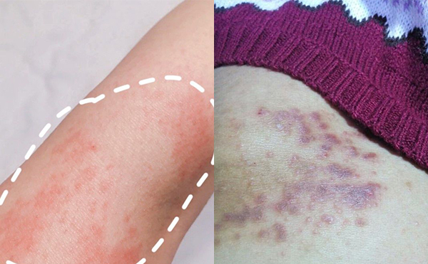 脫毛膏脫毛的效果怎么樣？