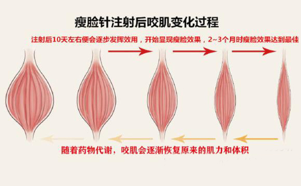 打瘦臉針打多少單位？