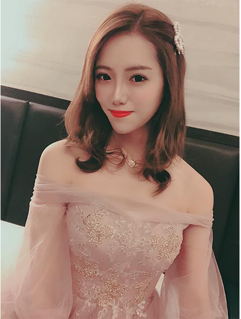 肋軟骨鼻綜合案例：術后效果1