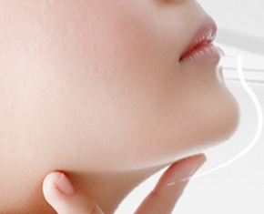 線雕可以保持多久？