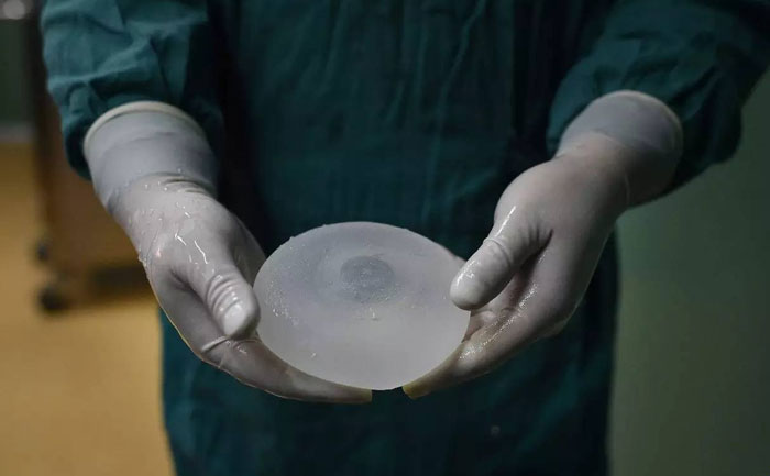 假體隆胸效果自然嗎？能維持多久？