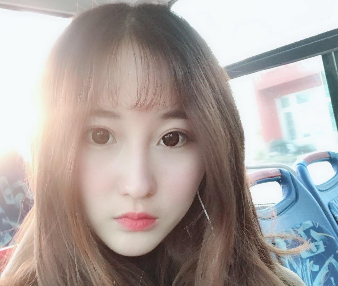 雙眼皮修復效果對比圖5