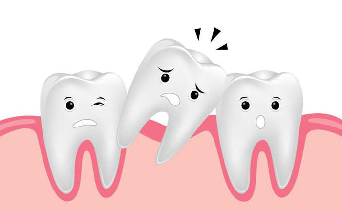 牙齒松動還能恢復嗎？