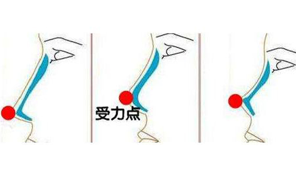 假體隆鼻假體取出難度大嗎?假體取出會怎么樣?