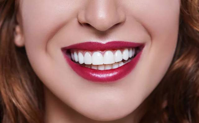 牙齒貼面怎么做？