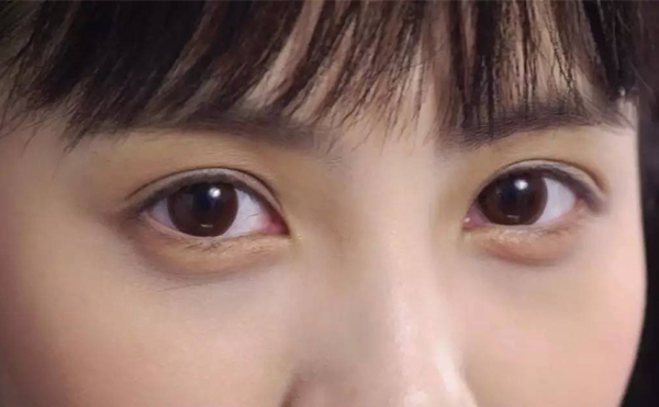 豐臥蠶的手術(shù)過(guò)程是什么?術(shù)后會(huì)不會(huì)留疤?