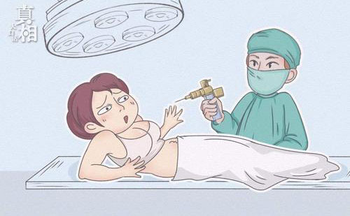 全身脂肪大概要多少錢(qián)？