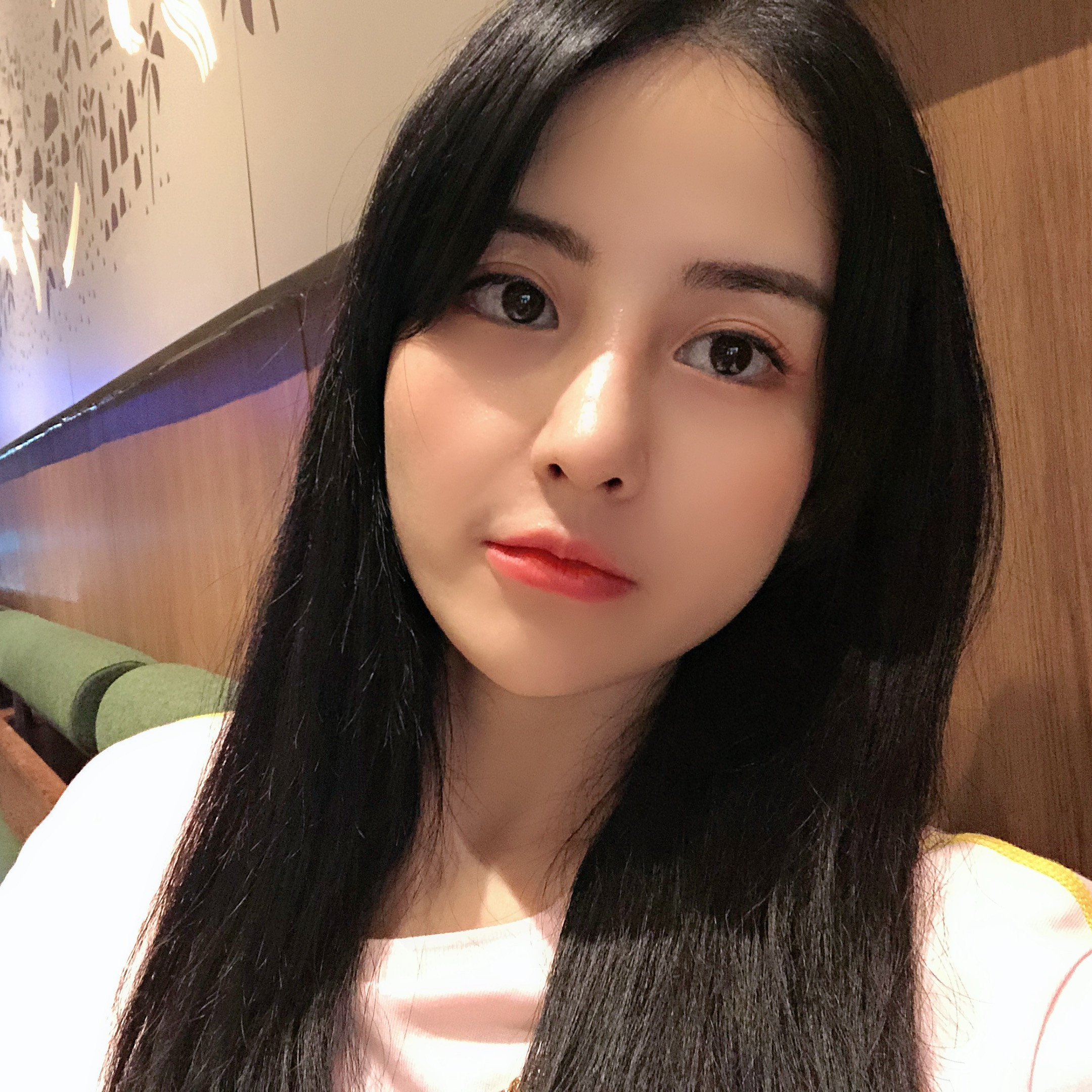 隆鼻手術(shù)術(shù)后效果3