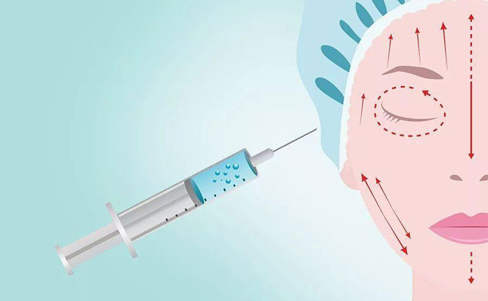 注射除皺針大概多少錢？