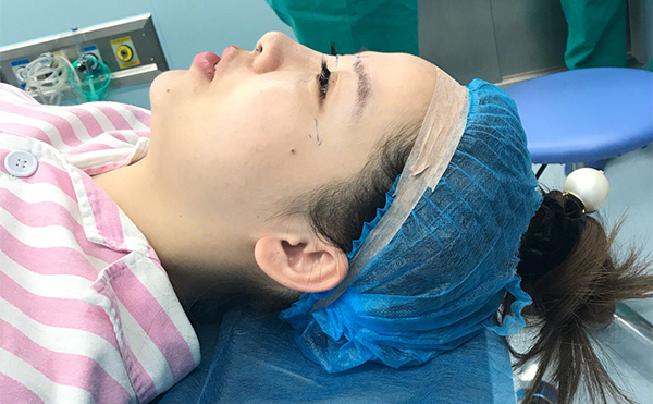 鼻綜合手術(shù)后怎樣是感染了