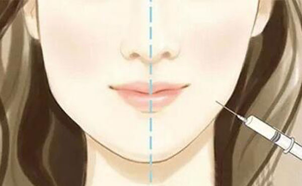 瘦臉針可能會出現(xiàn)什么風(fēng)險？