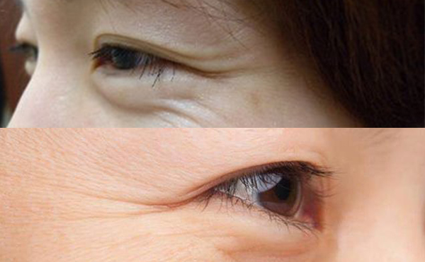 魚(yú)尾紋有哪幾種類型？