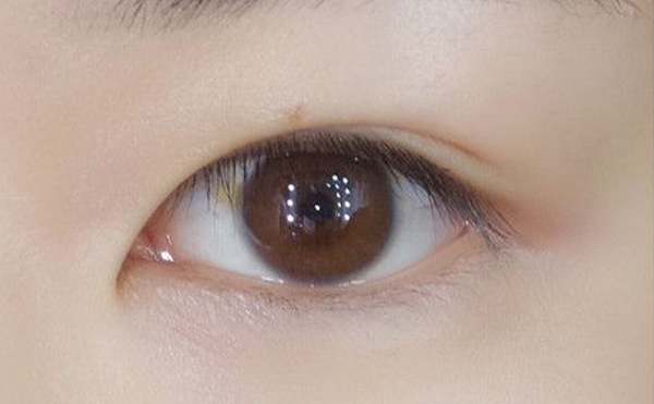 內(nèi)雙怎么才能變成雙眼皮?效果好嗎?