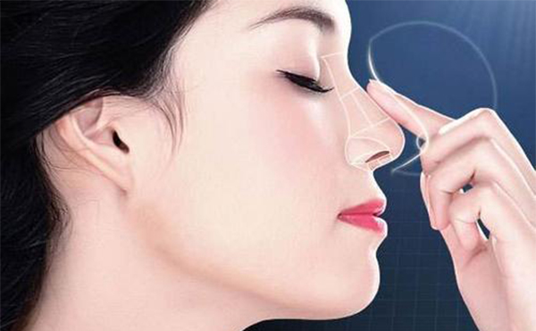 哪些人不能做鼻小柱缺損的修復手術(shù)?做鼻小柱缺損修復術(shù)前應注意什么?