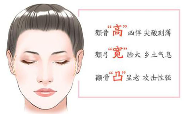 顴骨內(nèi)推整形適宜人群？