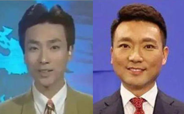 治療咬肌肥大的方法有哪些？