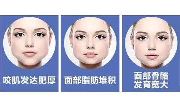 不想通過醫(yī)美整形的方式改善咬肌肥大就該這么做!