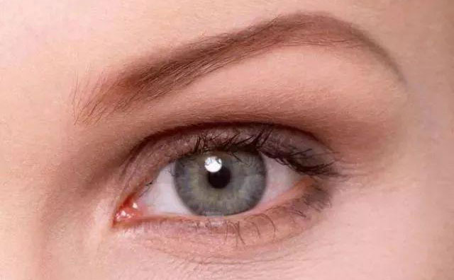 歐式雙眼皮是什么樣的？