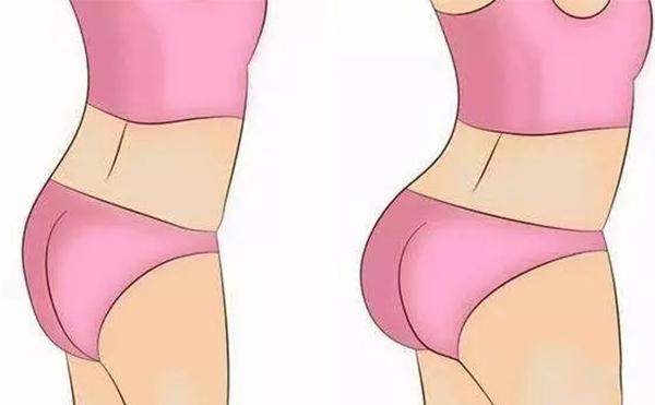 自體脂肪豐臀需要多次注射嗎?術(shù)后怎么護(hù)理?