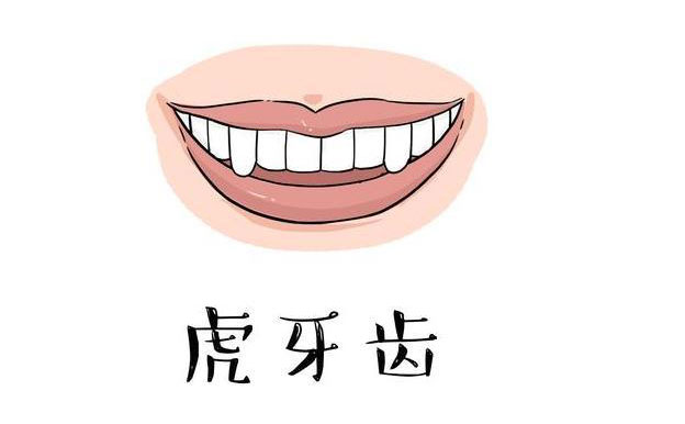 虎牙矯正需要多久？