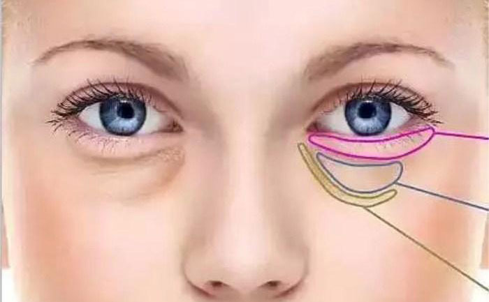 臥蠶跟眼袋怎么區(qū)分？臥蠶和眼袋有什么區(qū)別？