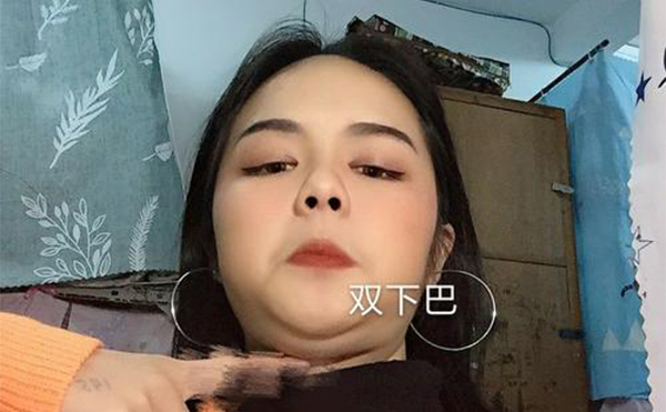 吸脂去雙下巴和溶脂瘦下巴有什么區(qū)別？