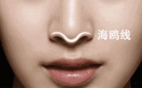 僅僅是對假體的形狀不滿意可以直接把原來的假體修好再放進(jìn)去嗎?