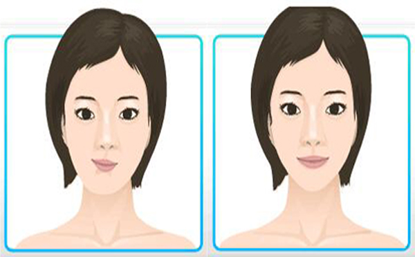 這些小習(xí)慣時(shí)間長(zhǎng)了會(huì)導(dǎo)致面部不對(duì)稱，快看看你有沒(méi)有