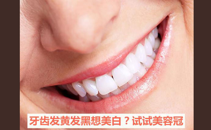 牙齒美容冠大約多少錢？牙齒美容冠怎么做的？