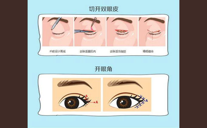 眼部修復手術包括什么項目？